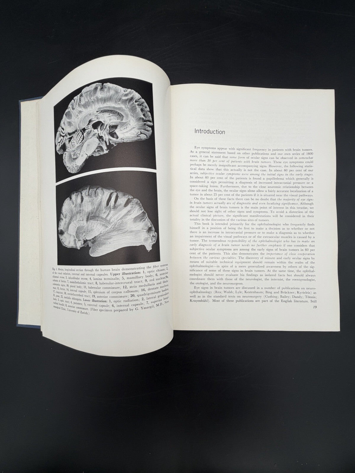 Eye Symptoms in Brain Tumors 1961 Alfred Huber MD Medical Ophthalmology Textbook