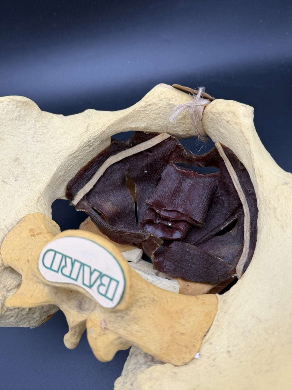 Vintage Baird Medical Anatomical Pelvis Model w/ Pelvic Floor Anatomy