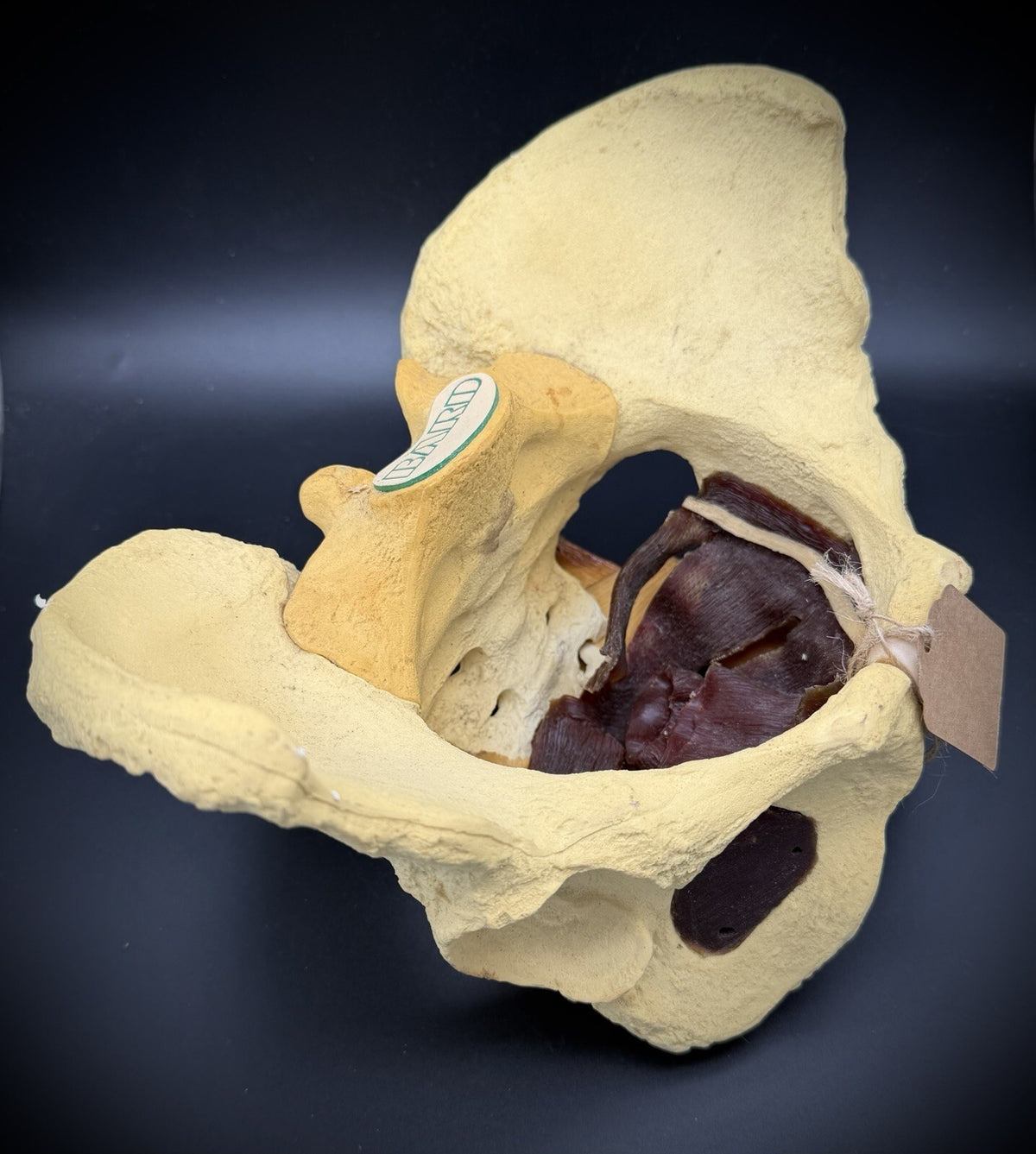 Vintage Baird Medical Anatomical Pelvis Model w/ Pelvic Floor Anatomy