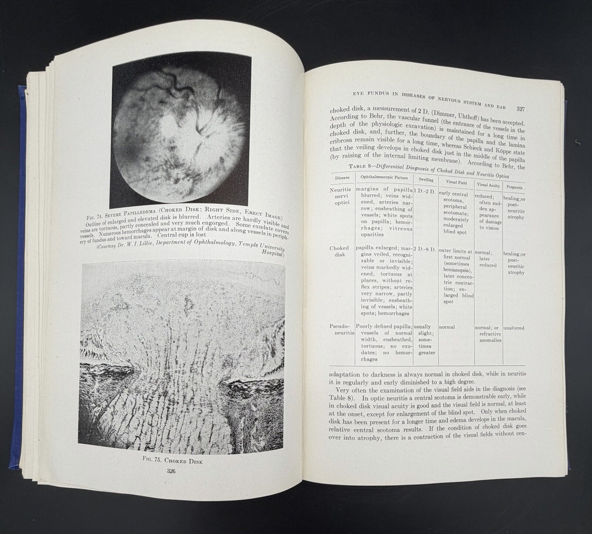 Neurology of the Eye, Ear, Nose, and Throat by E.A. Spiegel & I. Sommer (1944)