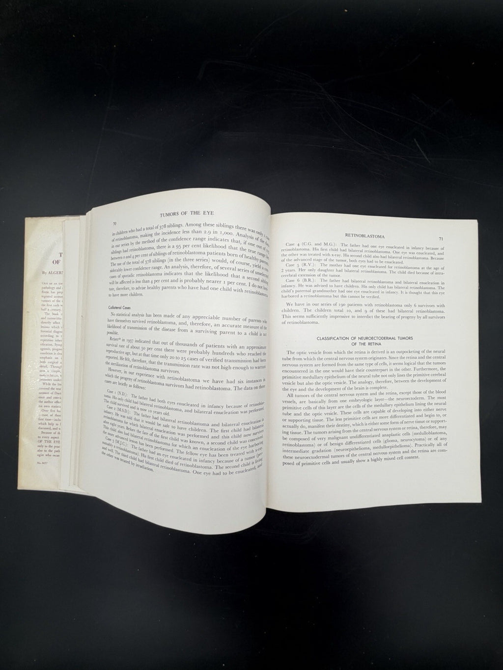 Vintage Book, 1951 Tumors of the Eye Algernon B Reese 1st Edition Dust Jacket Ephemera