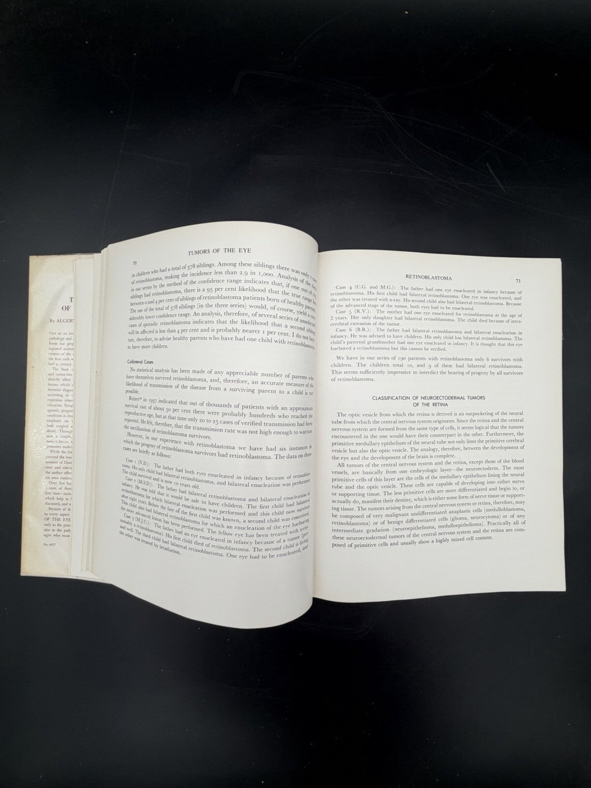 Vintage Book, 1951 Tumors of the Eye Algernon B Reese 1st Edition Dust Jacket Ephemera