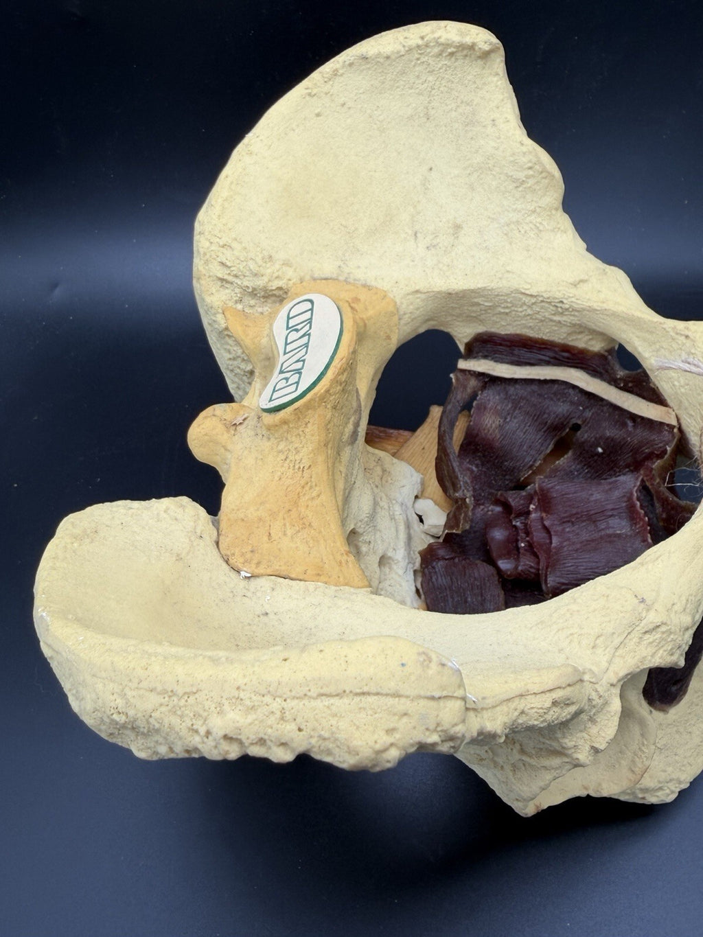Vintage Baird Medical Anatomical Pelvis Model w/ Pelvic Floor Anatomy
