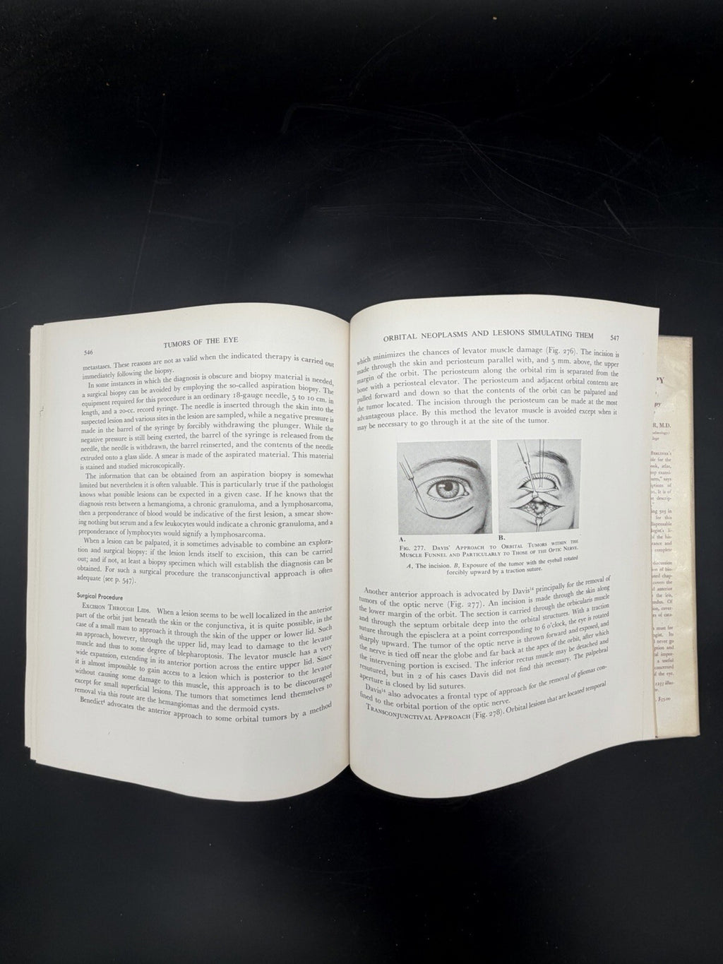 Vintage Book, 1951 Tumors of the Eye Algernon B Reese 1st Edition Dust Jacket Ephemera