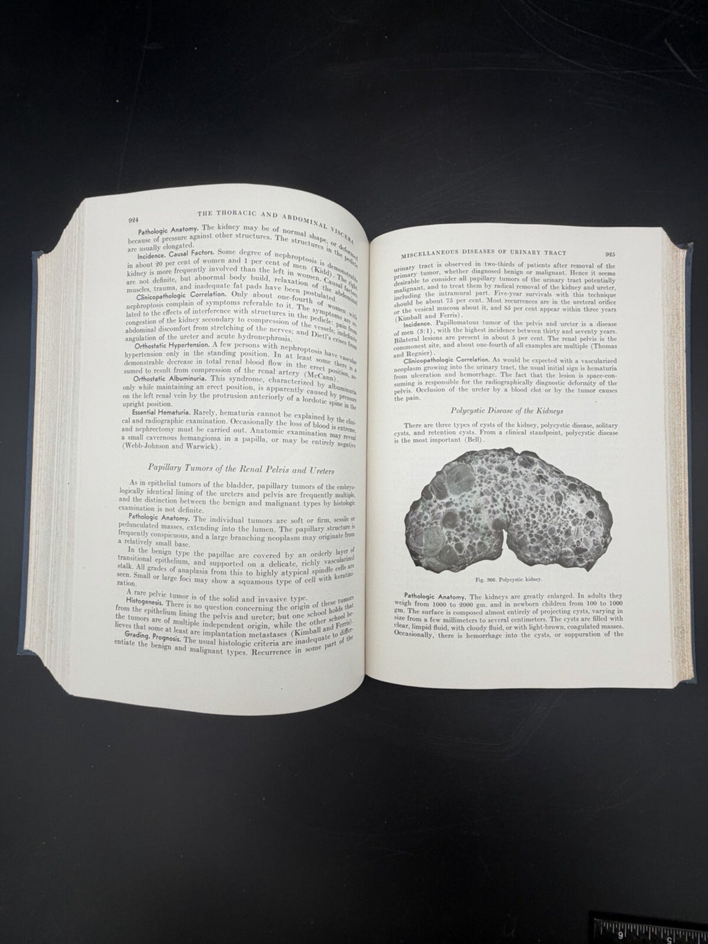 1944 A Textbook of Pathology Robert Allan Moore W.B. Saunders Medical History