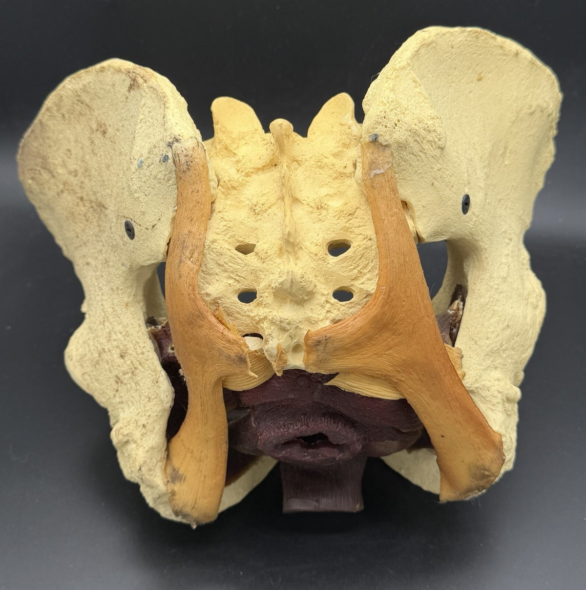 Vintage Baird Medical Anatomical Pelvis Model w/ Pelvic Floor Anatomy