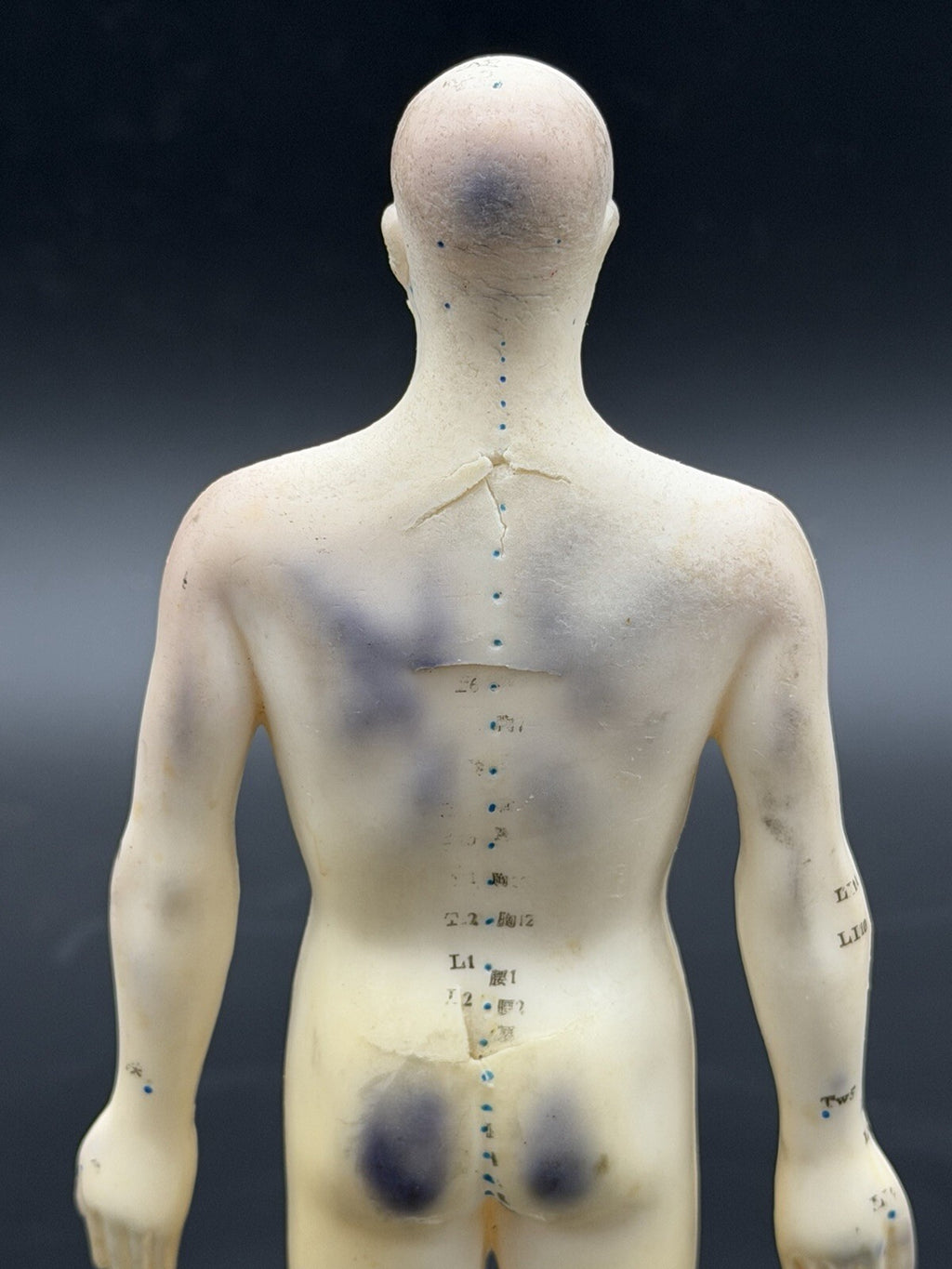Vintage Tam's Tong Ren Acupuncture Model Human Figure 10 Inch TCM Reference Old