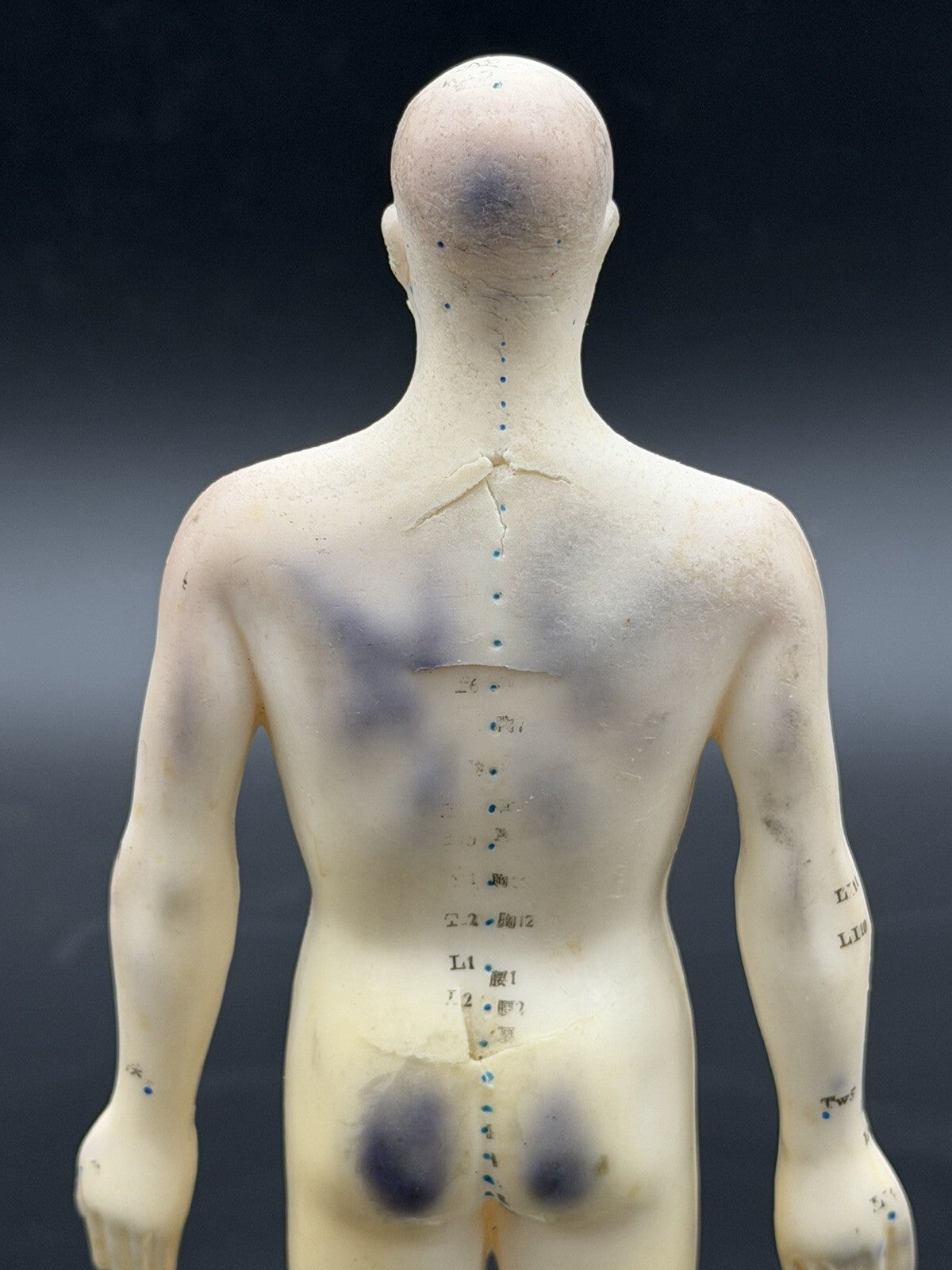 Vintage Tam's Tong Ren Acupuncture Model Human Figure 10 Inch TCM Reference Old