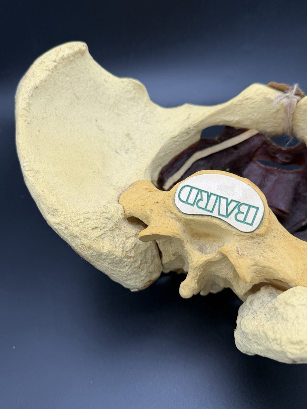 Vintage Baird Medical Anatomical Pelvis Model w/ Pelvic Floor Anatomy