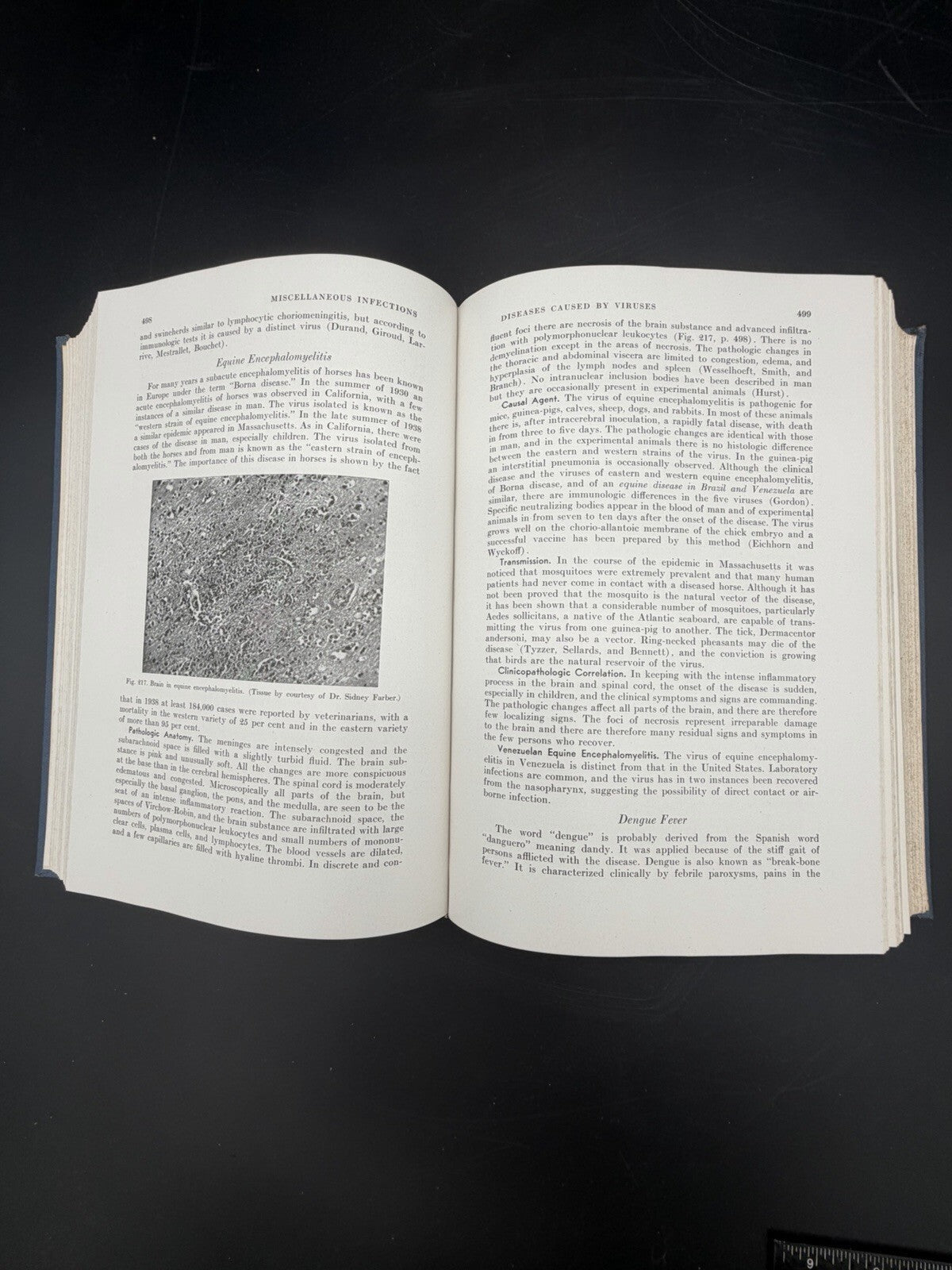 1944 A Textbook of Pathology Robert Allan Moore W.B. Saunders Medical History