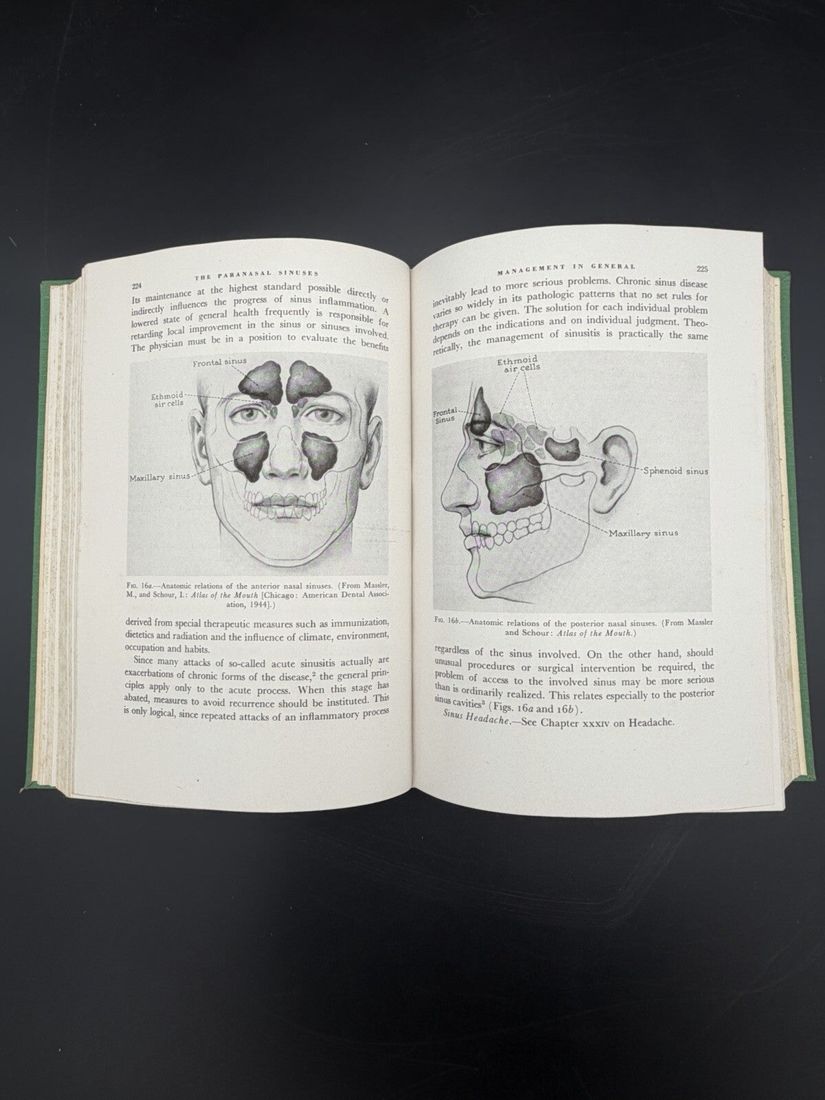 1946 Office Treatment of the Nose Throat & Ear Abraham R. Hollender 2nd Edition