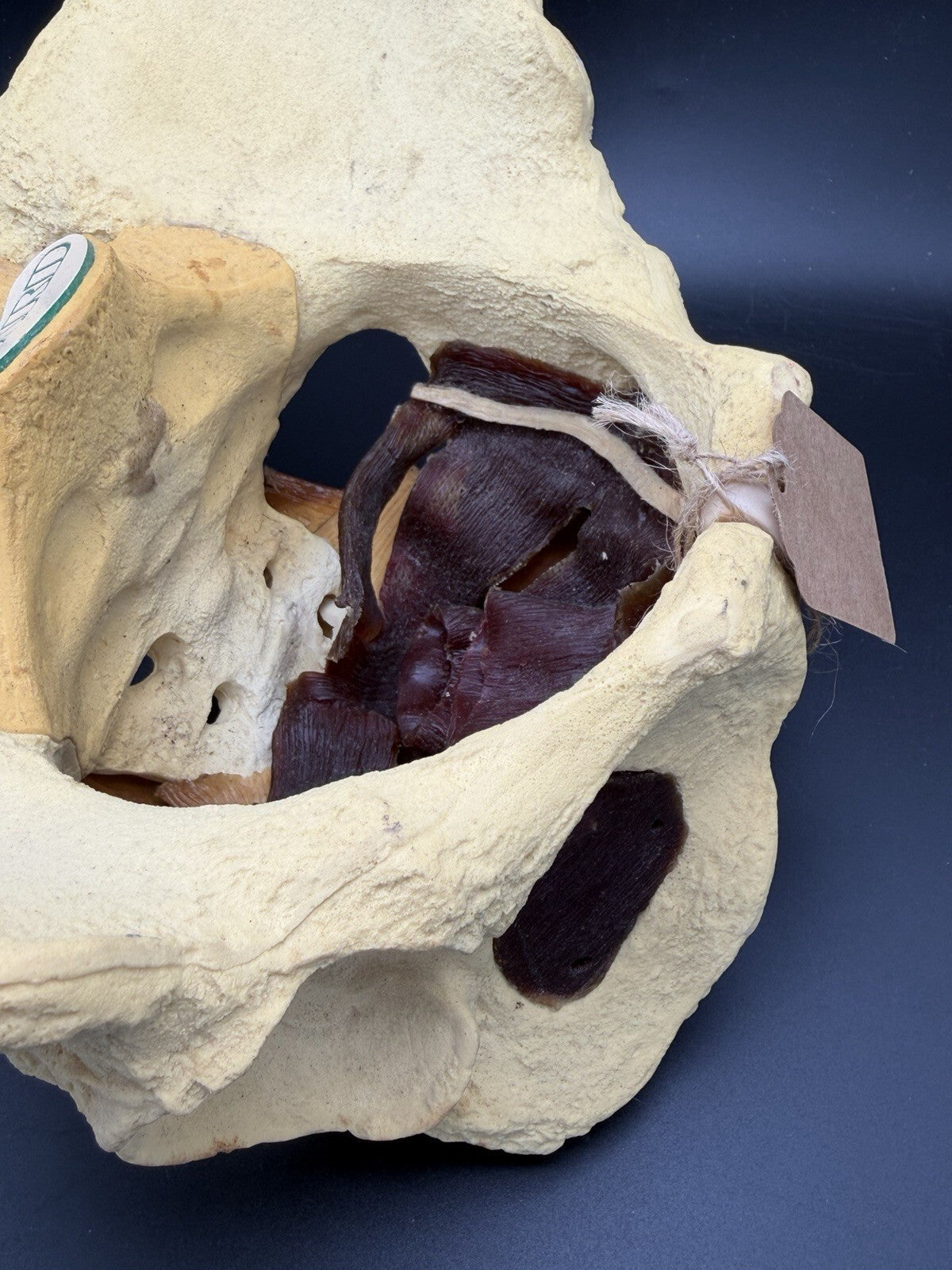 Vintage Baird Medical Anatomical Pelvis Model w/ Pelvic Floor Anatomy