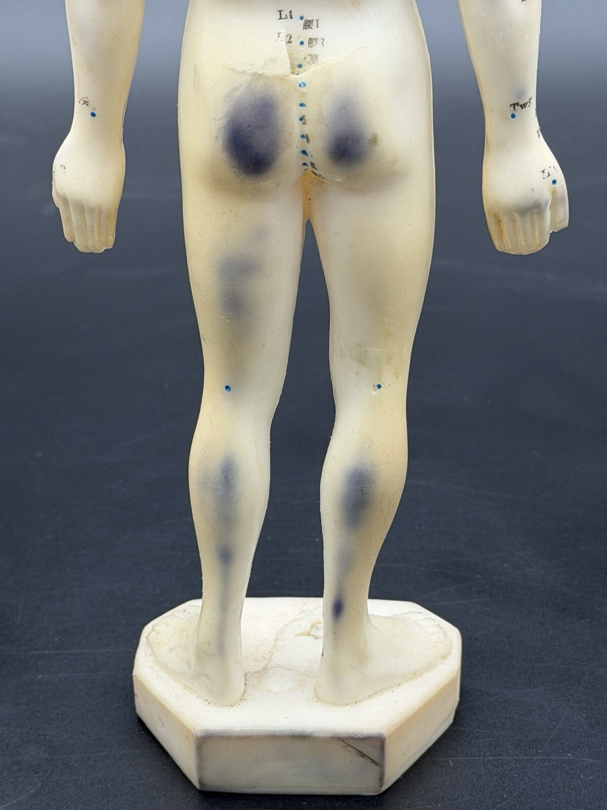 Vintage Tam's Tong Ren Acupuncture Model Human Figure 10 Inch TCM Reference Old