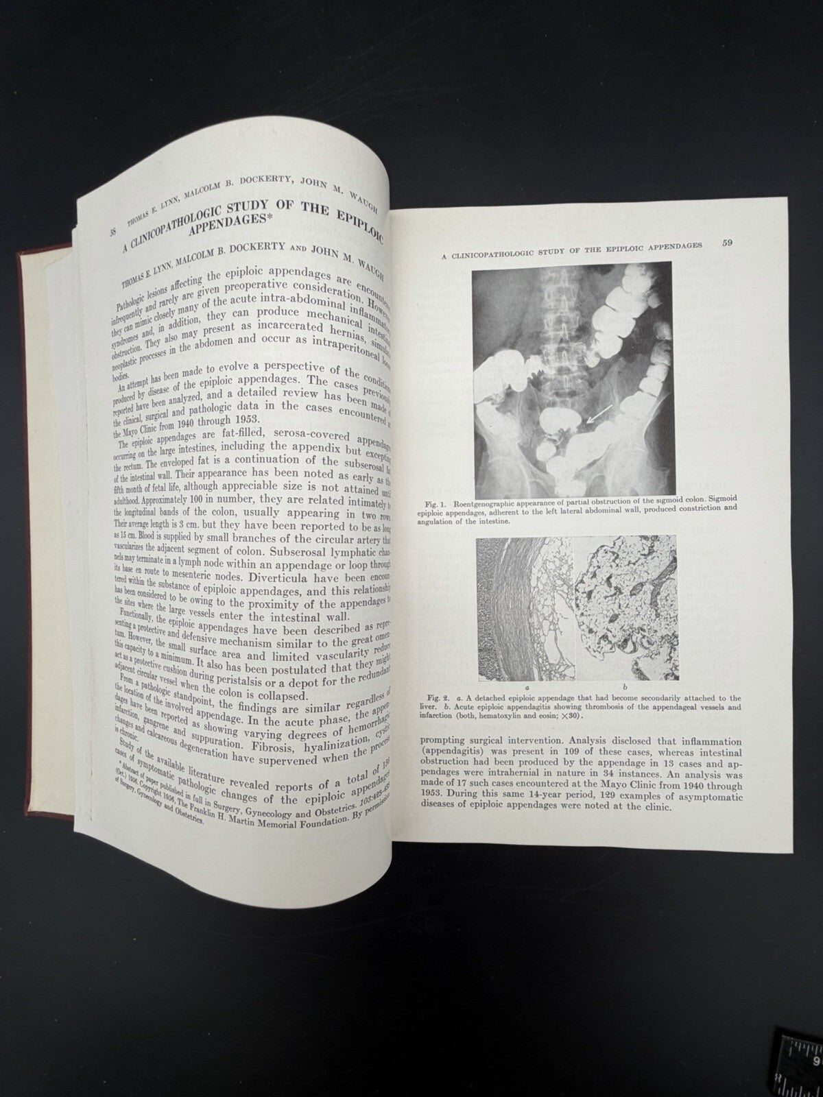 Collected Papers of the Mayo Clinic & The Mayo Foundation Volume XLIX (49) 1957